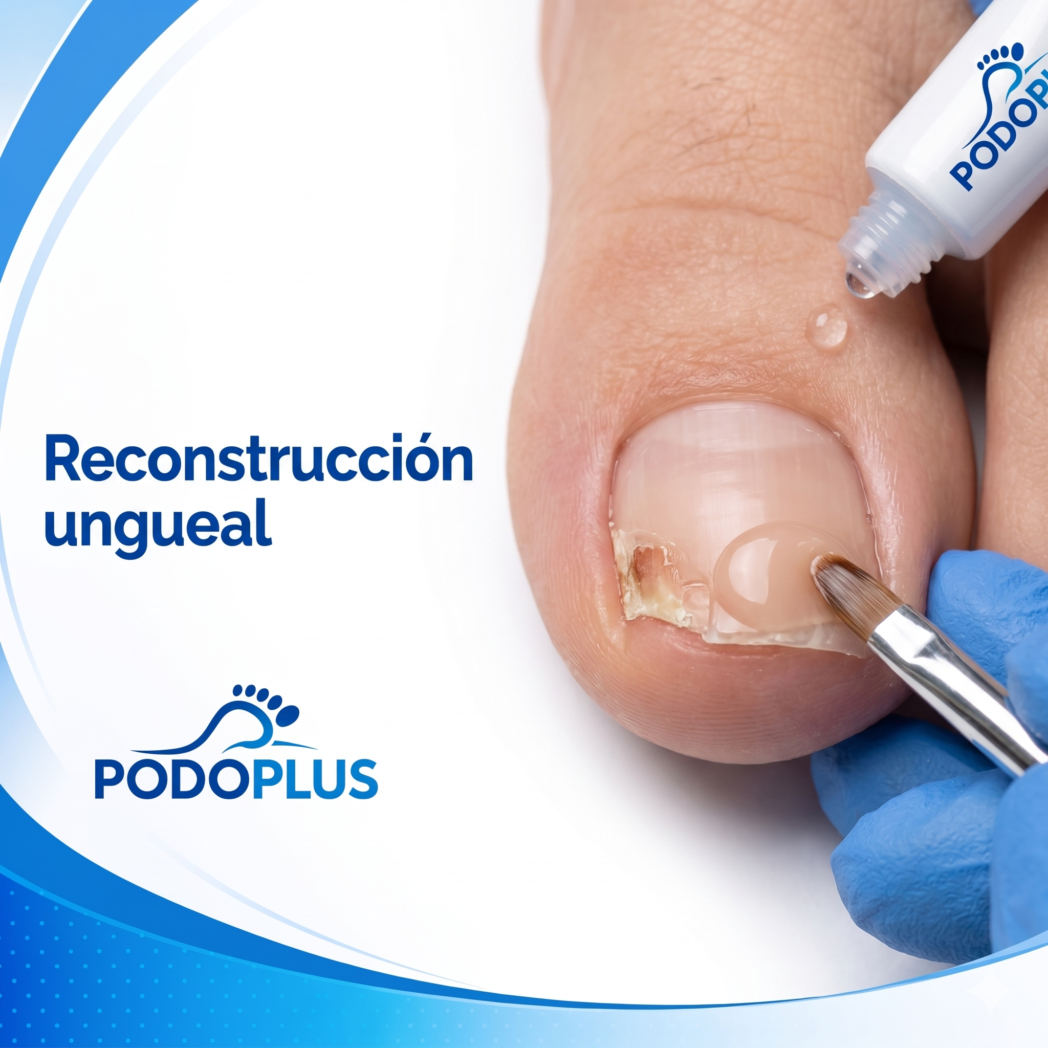 Reconstrucción ungueal